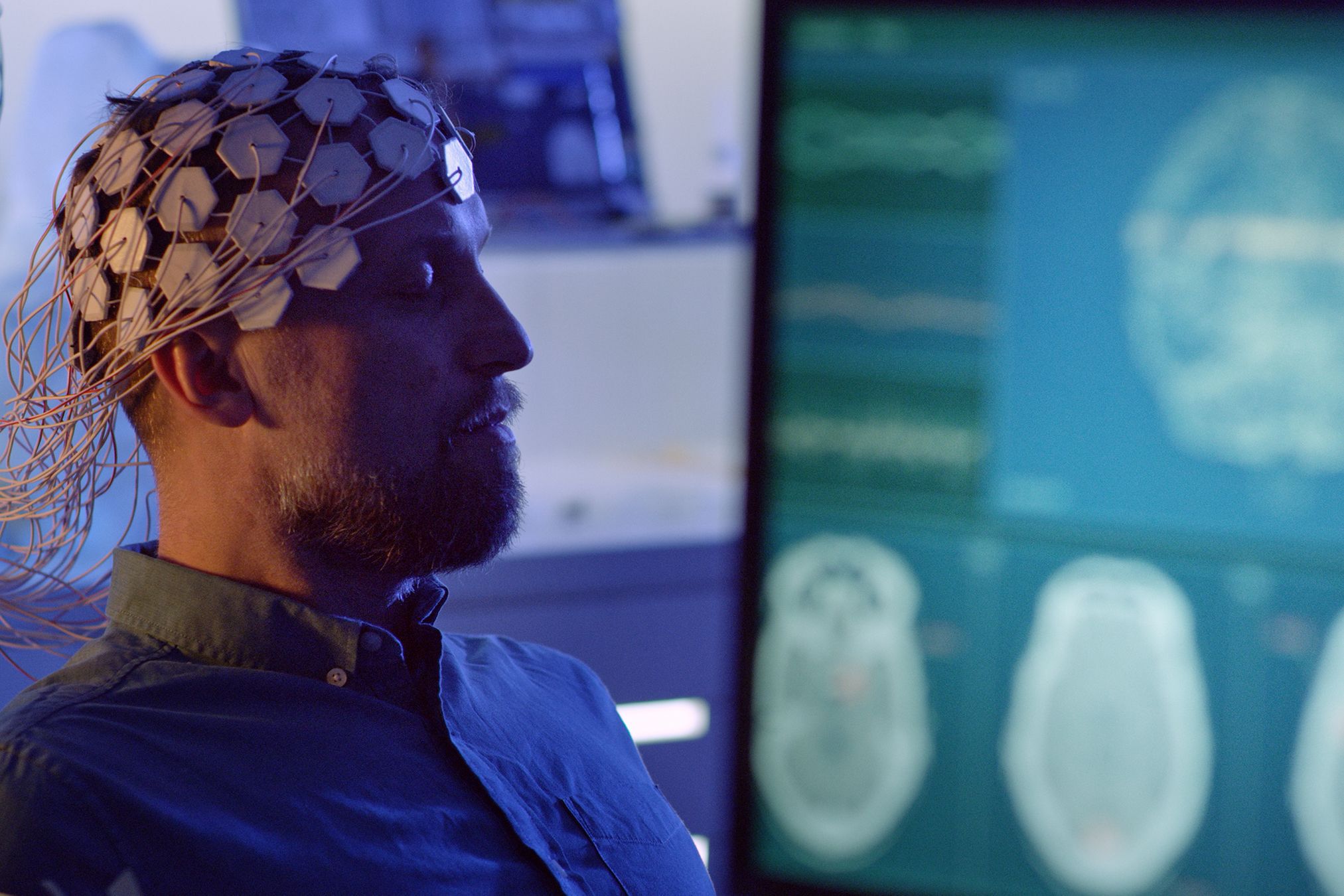Image may contain EEG Scan Accessories Adult Person EEG electrodes Brain scans Computer Hardware Electronics and Hardware